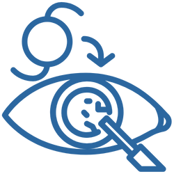 Cirurgia de Catarata