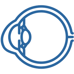 Cirurgia de Ceratocone